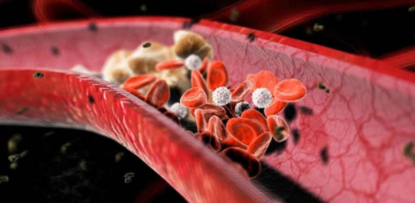 Kako lako sniziti holesterol u krvi