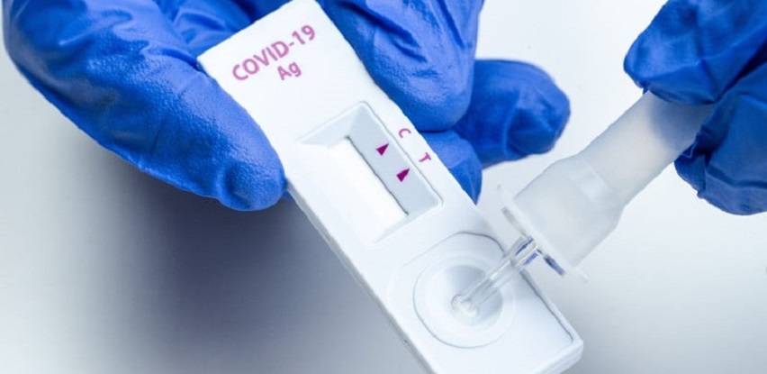 Brzo - Antigen testiranje na Covid-19