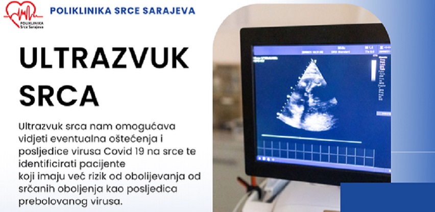 Poliklinika Srce Sarajeva ultrazvuk srca