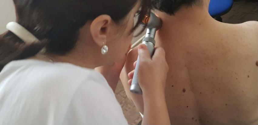 INZ organizuje besplatne preglede na melanom kože